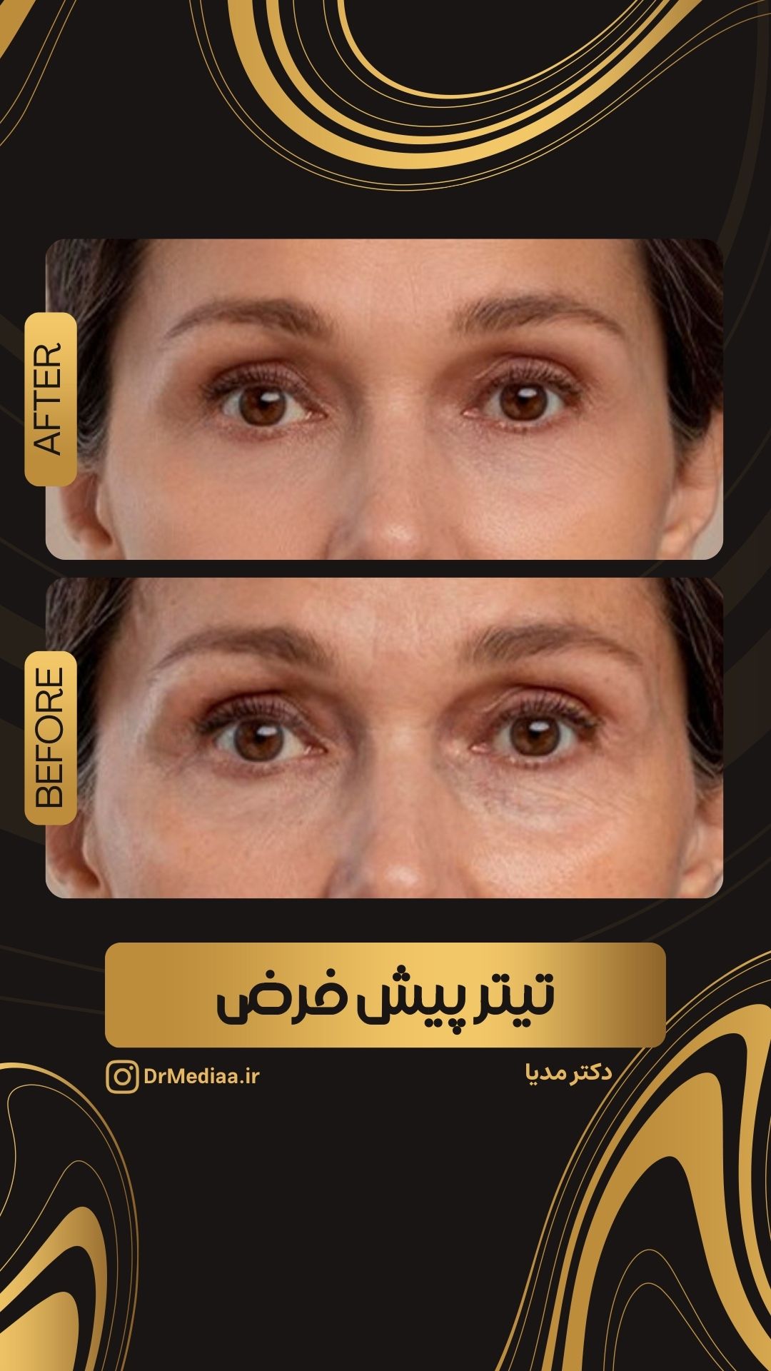 قالب ریل چهار